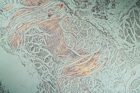 显微镜下病组织氨基状菌积结舌存款考试宏观舌头康复药品蛋白病理组织学薄片图片