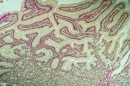 显微镜下大肠胃 内含离心组织10憩室溃疡药品组织学病理细胞考试宏观薄片医生图片