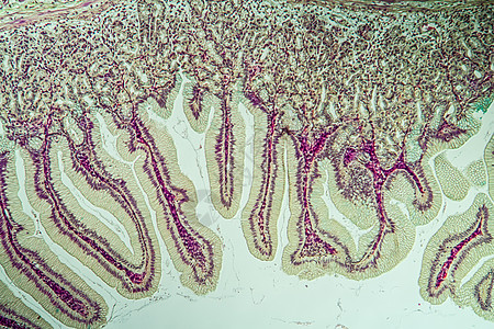 显微镜下大肠胃 内含离心组织10诊断薄片组织学医生疾病憩室病理宏观溃疡科学图片