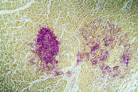 Candida 心肌中的Candida 一个艾滋病病人的心脏肌肉 100x酵母疾病组织薄片药品诊断考试学习细胞感染图片