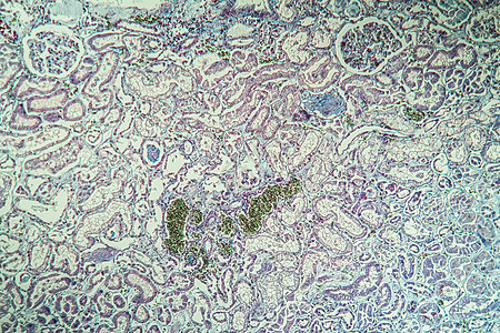 肾脏中的纤维素沉积 显微镜检查 100x宏观科学疾病组织学药品考试薄片调查组织细胞图片
