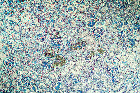 肾脏中的纤维素沉积 显微镜检查 100x考试细胞组织学科学宏观组织薄片病理调查疾病图片