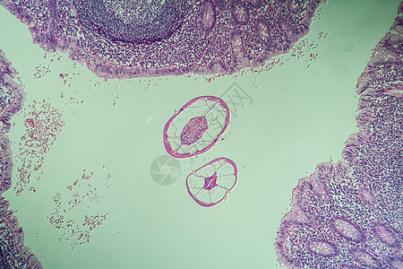 肠道中的氧化物 虫 显微镜检查 100x诊断药品宏观薄片疾病锥尾寄生虫考试附录盲肠图片