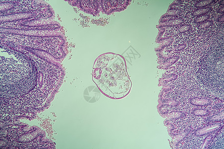 肠道中的氧化物 虫 显微镜检查 100x宏观寄生虫病理锥尾药品薄片疾病细胞组织盲肠图片