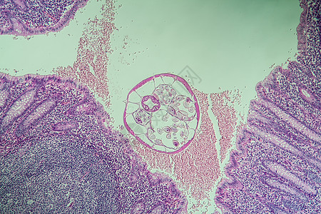 肠道中的氧化物 虫 显微镜检查 100x薄片附录寄生虫盲肠组织诊断尾巴考试春虫病理图片