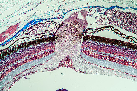 200x 眼睛中鱼的光学神经神经考试科学视网膜薄片组织细胞诊断组织学宏观疾病图片