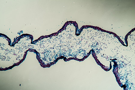 通过地环共生体的交叉剖口 100x共生体藻类生菌植物薄片绿藻植物学科学菌丝菌类图片