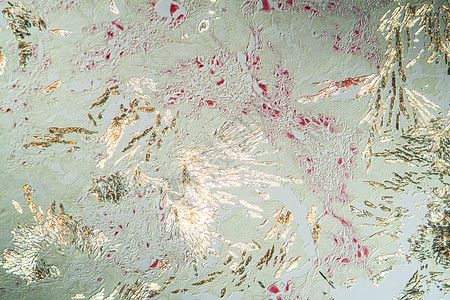 细胞组织组织第100节内的关节炎口腔结晶体痛风薄片宏观组织学疾病病理水晶药品科学放大镜背景图片