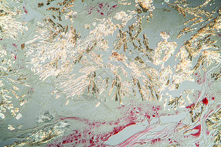 细胞组织组织第100节内的关节炎口腔结晶体水晶生物学组织学宏观薄片药品痛风疾病科学病理背景图片