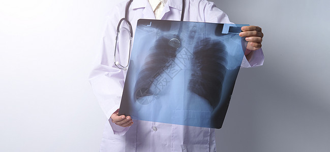 亚洲女医生持有和检查肺部X光片x射线胸椎骨骼扫描病人诊所x光结核专家外科图片