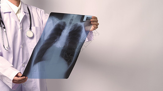亚洲女医生持有和检查肺部X光片医师射线结核诊所照相考试药品诊断肺炎胸部图片