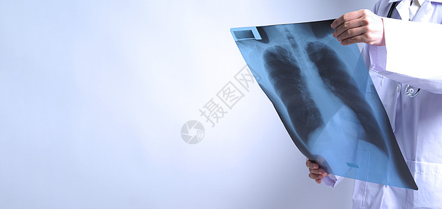 亚洲女医生持有和检查肺部X光片肺炎外科临床测试药品结核专家医师诊所放射科图片
