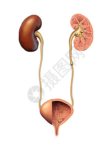 肾和小便石图片