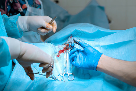 一位戴着面具的男性外科医生在手术室里与一名助手和一名麻醉师一起手术 医疗队执行手术 戴着手套的手拿着一个微不足道的计划 染成蓝色图片
