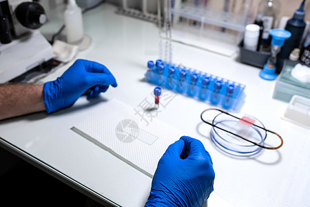 科学家准备血液样本用于显微镜研究 将血样放在显微镜载玻片上疾病男人男性手套生物工作测试技术员吸管技术图片