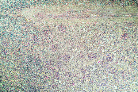 组织第100节中氢肾脏炎症诊断科学细胞放大镜组织学肾炎药品疾病病理生物学图片