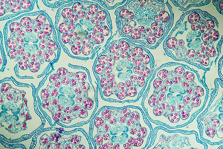 横跨第100节的易腐蚀性组织枕形细胞植物学组织学草药罗盘花序横截面植物图片