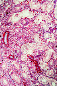 横跨第100节的派克肾脏肾体肾细胞放大镜红色组织细胞科学泌尿系统宏观图片