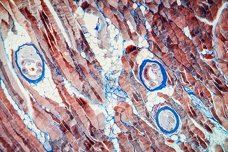100x 肌肉组织中的特里希尼寄生虫蛔虫科学药品病原体病原宏观感染疾病图片