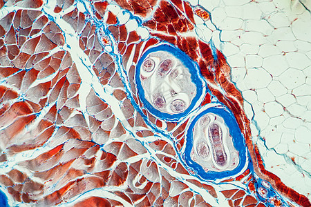 100x 肌肉组织中的特里希尼寄生虫病原蛔虫病原体宏观科学疾病药品感染背景图片
