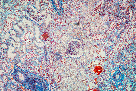 显微镜下的营养性肾脏组织 100x萎缩炎症科学宏观细胞药品病理肾细胞放大镜疾病图片