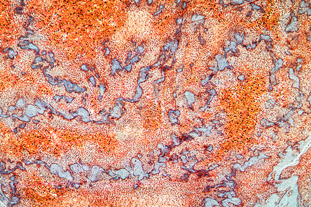 显微镜下脂肪心脏组织宏观蓝色放大镜冠状动脉细胞疾病药品科学肥胖纸巾图片