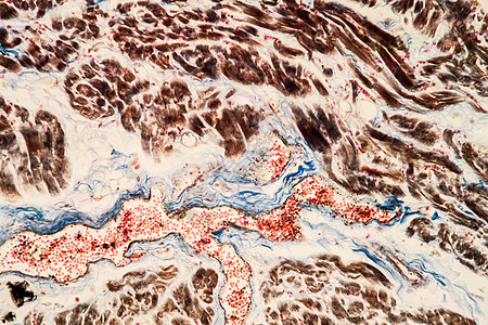 显微镜下脂肪心脏组织药品放大镜蓝色纤颤科学肥胖纸巾冠状动脉疾病细胞图片