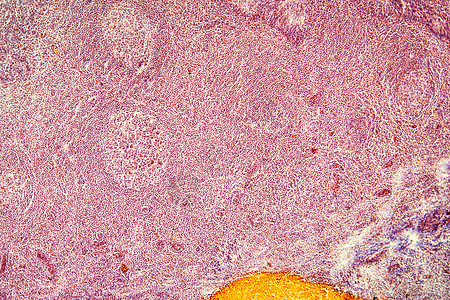 显微镜100x下横截面的杏仁扁桃体上颚科学组织宏观器官蓝色感染细胞药品图片