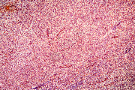 显微镜100x下横截面的杏仁科学组织药品宏观器官上颚感染细胞放大镜淋巴图片