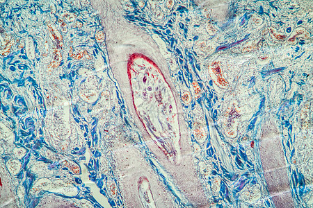 显微镜下的毛发泡皮皮肤组织 100x蠕形螨尔螨毛囊螨虫科学药品蓝色放大镜寄生虫宏观图片