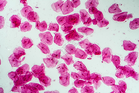 200x口腔菌菌菌的热室细胞上皮黏膜粘膜组织学放大镜药品组织宏观科学口腔图片