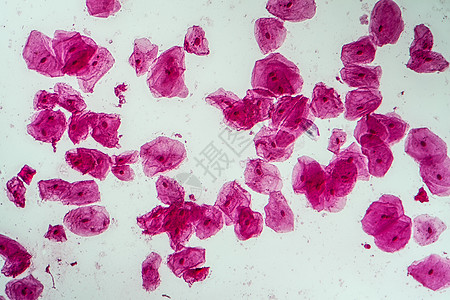 200x口腔菌菌菌的热室细胞蓝色科学口腔药品宏观粘膜上皮黏膜组织放大镜图片