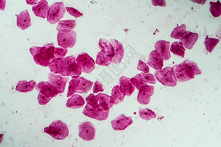200x口腔菌菌菌的热室细胞粘膜组织黏膜蓝色口腔科学组织学上皮药品放大镜图片