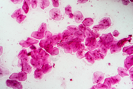200x口腔菌菌菌的热室细胞黏膜粘膜蓝色口腔科学药品宏观放大镜上皮组织图片