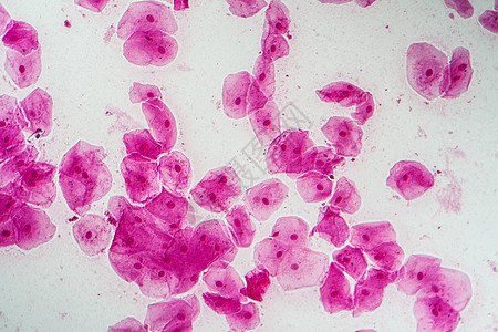 200x口腔菌菌菌的热室细胞科学粘膜宏观放大镜上皮组织蓝色黏膜药品口腔图片