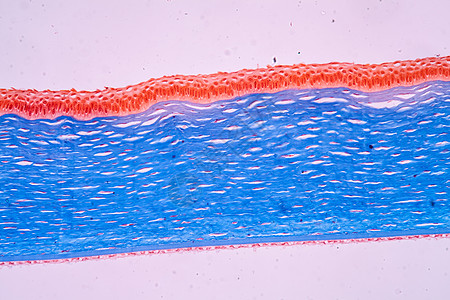 显微镜下眼组织角角 100x宏观眼球泪液眼泪放大镜科学细胞折射眼睛眼皮图片