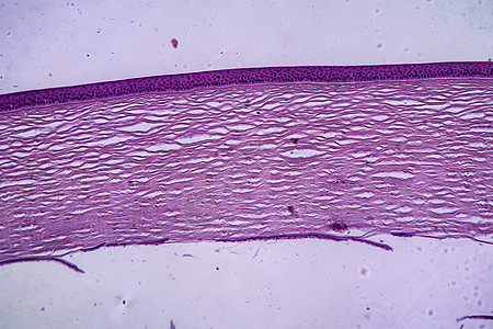 显微镜下眼组织角角 100x眼球眼皮眼泪泪液宏观组织学折射放大镜光线眼睛图片