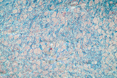 显微镜下色素组织 100x口腔放大镜上皮科学细胞宏观味觉粘膜组织学软腭图片