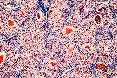 显微镜下的甲状腺组织 200x科学细胞荷尔蒙内分泌织囊荷尔蒙腺宏观放大镜内分泌腺药品图片