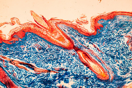100x 显微镜下有毛发根组织骨浆细胞皮肤显微术宏观上皮放大镜科学头皮组织卵泡图片