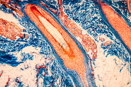 100x 显微镜下有毛发根组织骨浆头皮组织学毛囊显微术卵泡宏观腺体头发科学组织图片