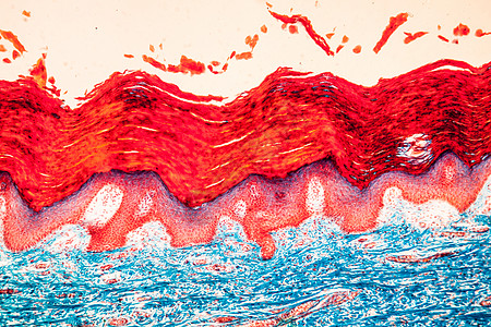 显微镜下的疤皮肤组织 100x毛孔放大镜组织学上皮科学结缔组织药品无毛细胞宏观图片