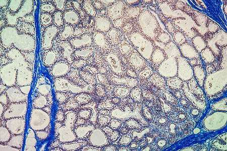显微镜下的乳腺癌组织 100x宏观分泌乳腺牛肉乳房组织学细胞放大镜牛奶腺体图片