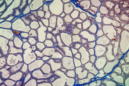 显微镜下的乳腺癌组织 100x细胞分泌牛肉组织学腺体乳腺牛奶科学宏观放大镜图片