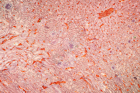 显微镜下的肾组织 100x药品肾细胞胶囊排泄肾小球组织学宏观肾体科学细胞图片