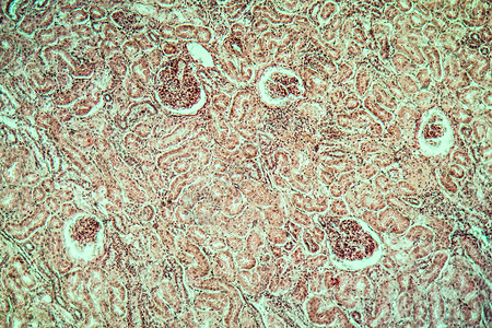 肾脏肺结核病组织 100x放大镜宏观组织学疾病流行病结核细胞瘟疫蓝色病理图片