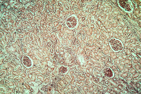 肾脏肺结核病组织 100x细胞结核放大镜疾病蓝色药品科学宏观瘟疫病理图片