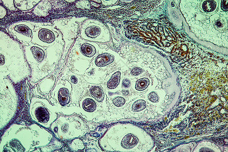 感染肝脏中的虫子 100x组织学病理药品组织宏观疾病蠕虫寄生虫科学细胞图片