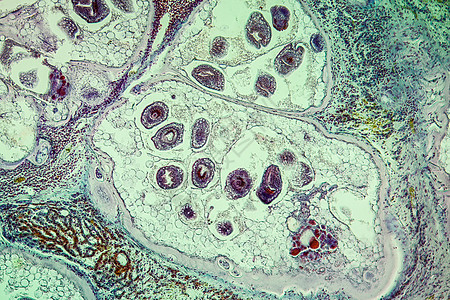 感染肝脏中的虫子 100x组织学寄生虫蠕虫组织病理细胞宏观科学疾病药品图片