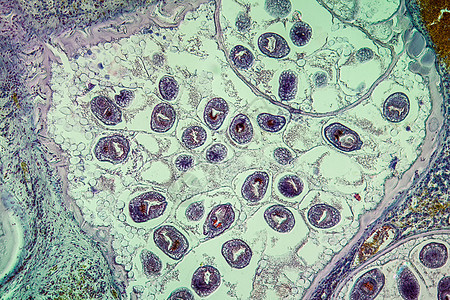 感染肝脏中的虫子 100x疾病蠕虫病理寄生虫组织药品科学宏观组织学细胞图片